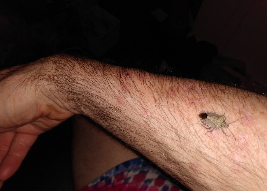 STINK BUG ON MY ARM
