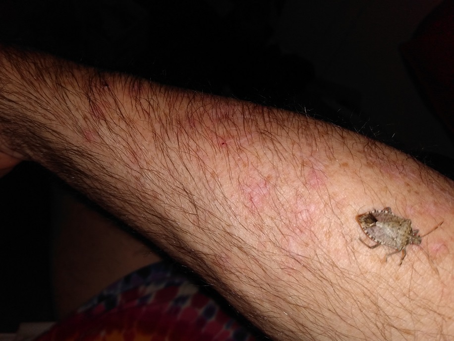 STINK BUG ON MY ARM